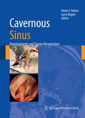 Cavernous Sinus