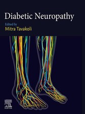 Diabetic Neuropathy