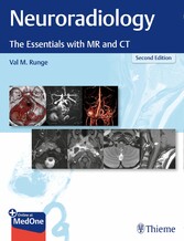 Neuroradiology