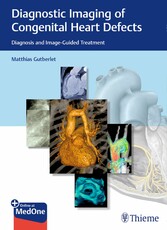 Diagnostic Imaging of Congenital Heart Defects