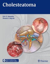 Cholesteatoma