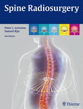 Spine Radiosurgery