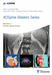 AOSpine Masters Series, Volume 2: Primary Spinal Tumors