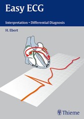 Easy ECG