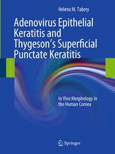 Adenovirus Epithelial Keratitis and Thygeson's Superficial Punctate Keratitis