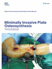 Minimally Invasive Plate Osteosynthesis