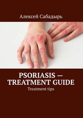 Psoriasis - treatment guide