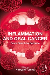 Inflammation and Oral Cancer