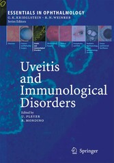 Uveitis and Immunological Disorders