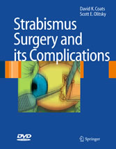 Strabismus Surgery and its Complications