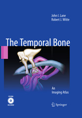 Temporal Bone