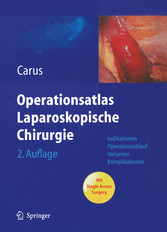 Operationsatlas Laparoskopische Chirurgie