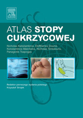 Atlas stopy cukrzycowej