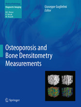 Osteoporosis and Bone Densitometry Measurements